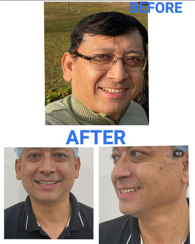 Dental treatment result